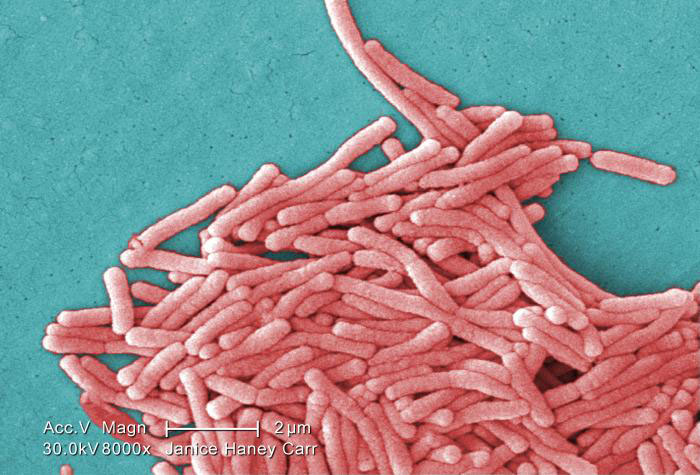 La CDC Advierte del Riesgo Elevado de Enfermedad del Legionario En Choferes