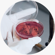 Microanalisis de Texas